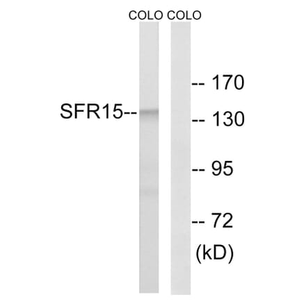Western Blot - Anti-SFRS15 Antibody (C18932) - Antibodies.com