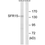 Western Blot - Anti-SFRS15 Antibody (C18932) - Antibodies.com