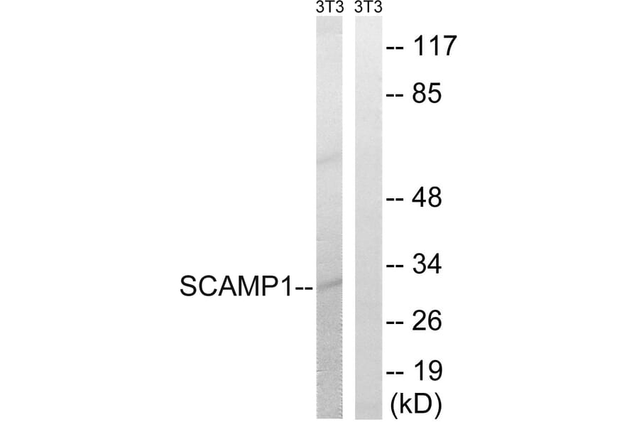 Western Blot - Anti-SCAMP1 Antibody (C18492) - Antibodies.com