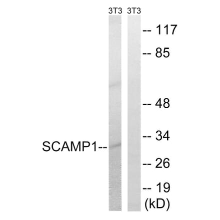 Western Blot - Anti-SCAMP1 Antibody (C18492) - Antibodies.com