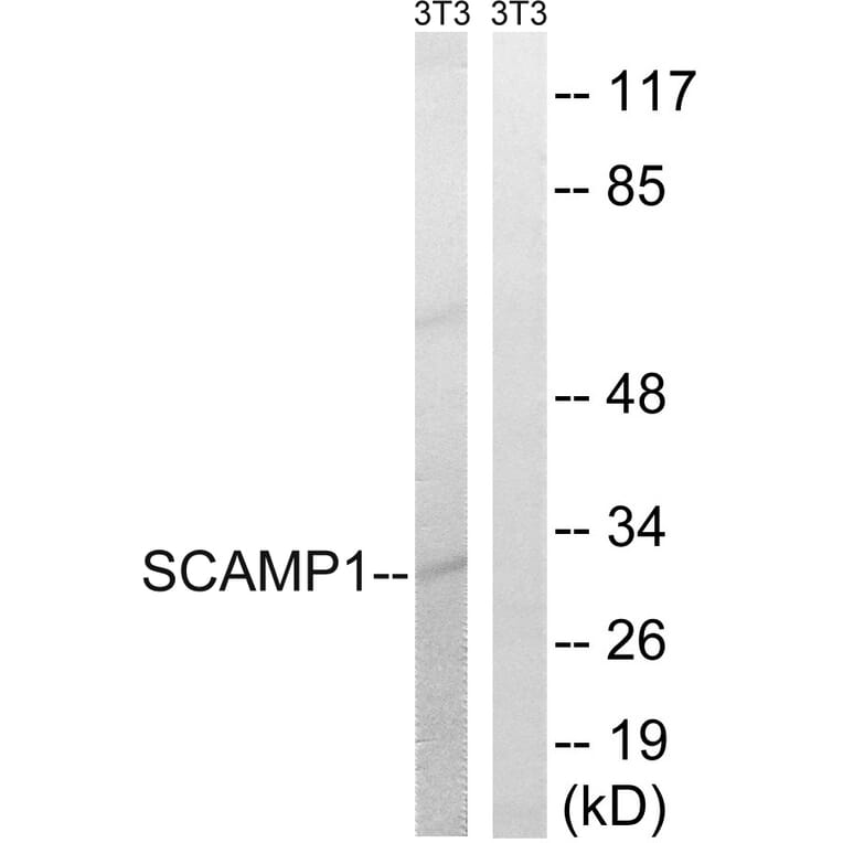 Western Blot - Anti-SCAMP1 Antibody (C18492) - Antibodies.com