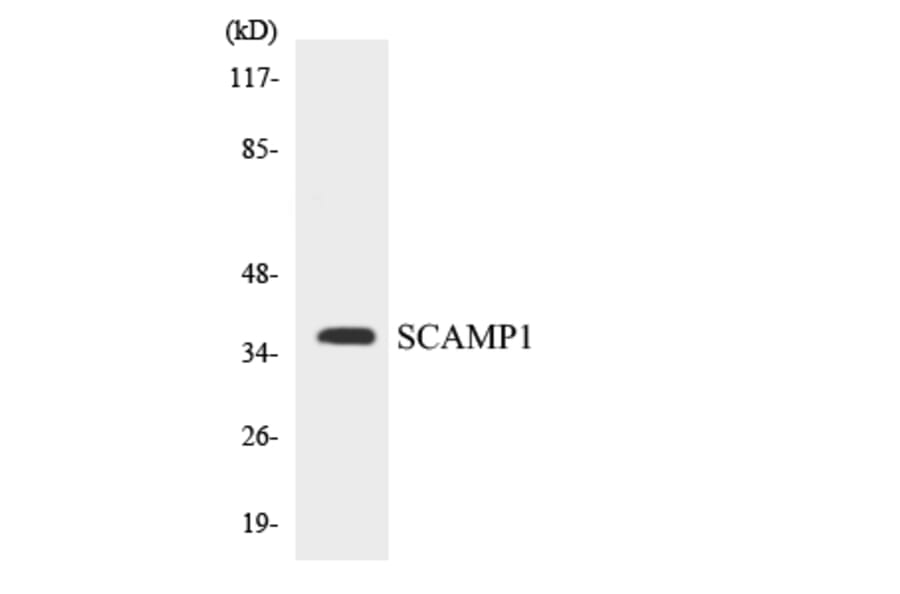 Western Blot - Anti-SCAMP1 Antibody (R12-3479) - Antibodies.com