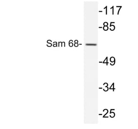 Western Blot - Anti-Sam 68 Antibody (R12-2343) - Antibodies.com