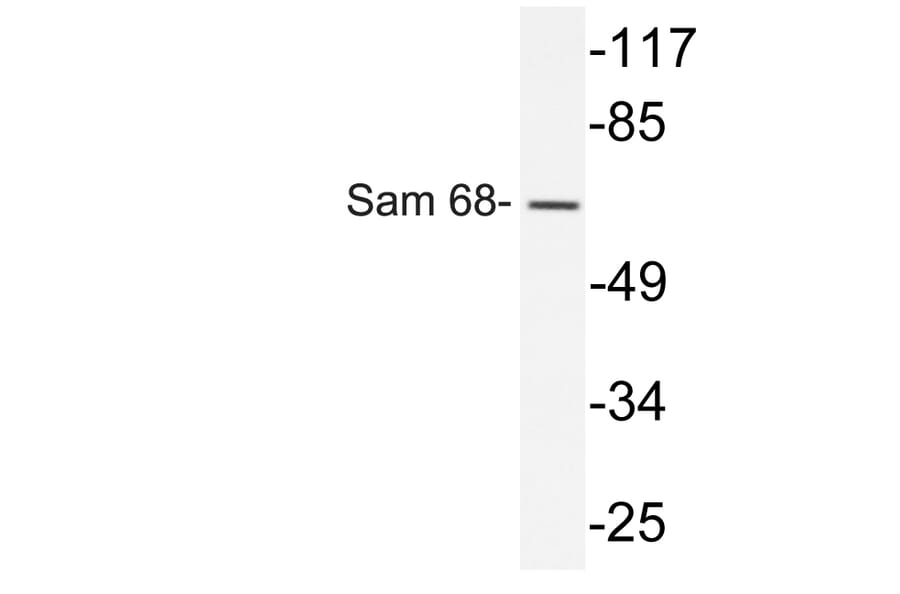 Western Blot - Anti-Sam 68 Antibody (R12-2343) - Antibodies.com