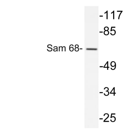 Western Blot - Anti-Sam 68 Antibody (R12-2343) - Antibodies.com