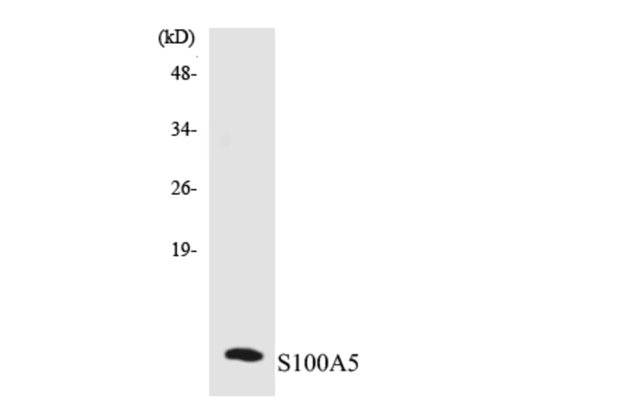 Western Blot - Anti-S100A5 Antibody (R12-3475) - Antibodies.com
