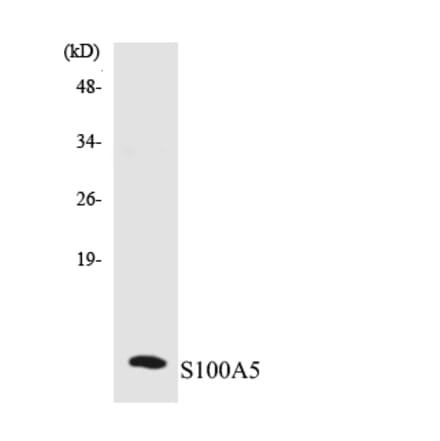 Western Blot - Anti-S100A5 Antibody (R12-3475) - Antibodies.com