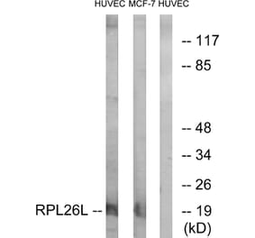 Western Blot - Anti-RPL26L Antibody (C14163) - Antibodies.com