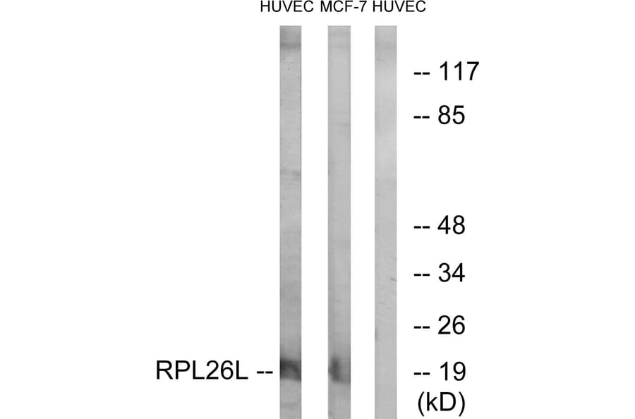 Western Blot - Anti-RPL26L Antibody (C14163) - Antibodies.com