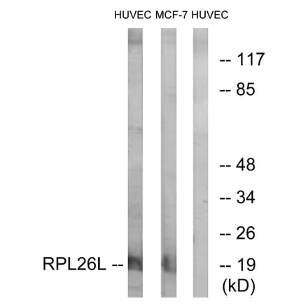 Western Blot - Anti-RPL26L Antibody (C14163) - Antibodies.com