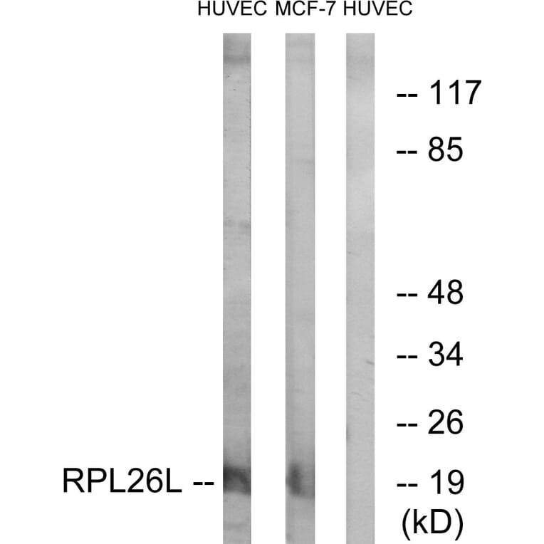 Western Blot - Anti-RPL26L Antibody (C14163) - Antibodies.com