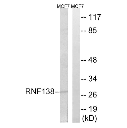 Western Blot - Anti-RNF138 Antibody (C15572) - Antibodies.com