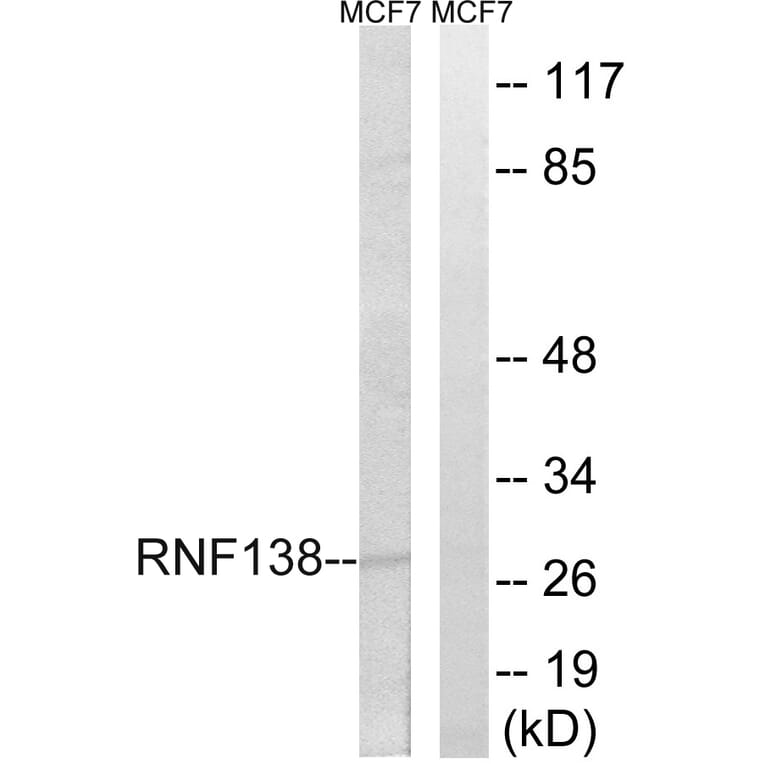 Western Blot - Anti-RNF138 Antibody (C15572) - Antibodies.com