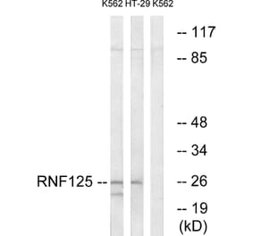 Western Blot - Anti-RNF125 Antibody (C15570) - Antibodies.com