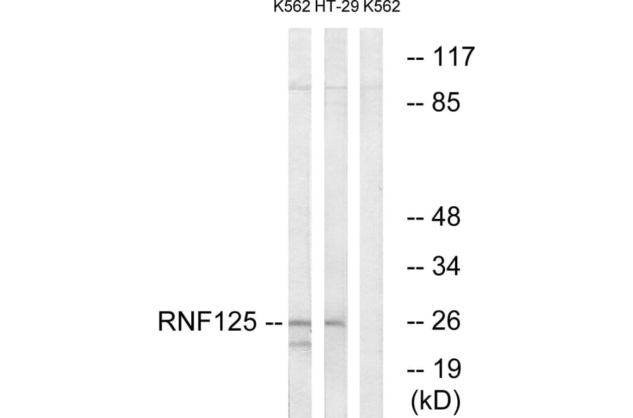 Western Blot - Anti-RNF125 Antibody (C15570) - Antibodies.com