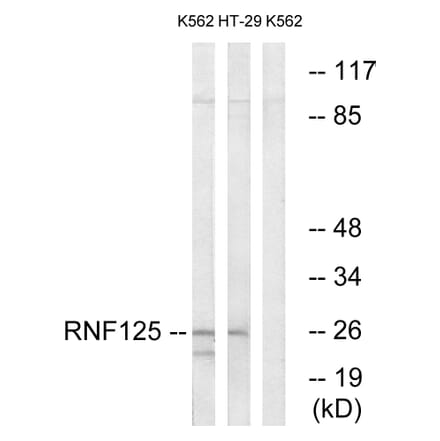 Western Blot - Anti-RNF125 Antibody (C15570) - Antibodies.com