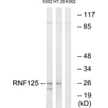 Western Blot - Anti-RNF125 Antibody (C15570) - Antibodies.com