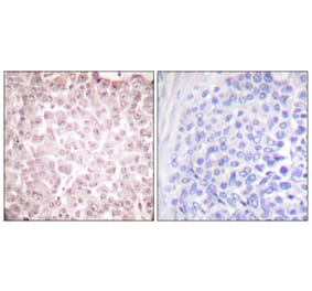 Immunohistochemistry - Anti-RCBTB1 Antibody (C0314) - Antibodies.com
