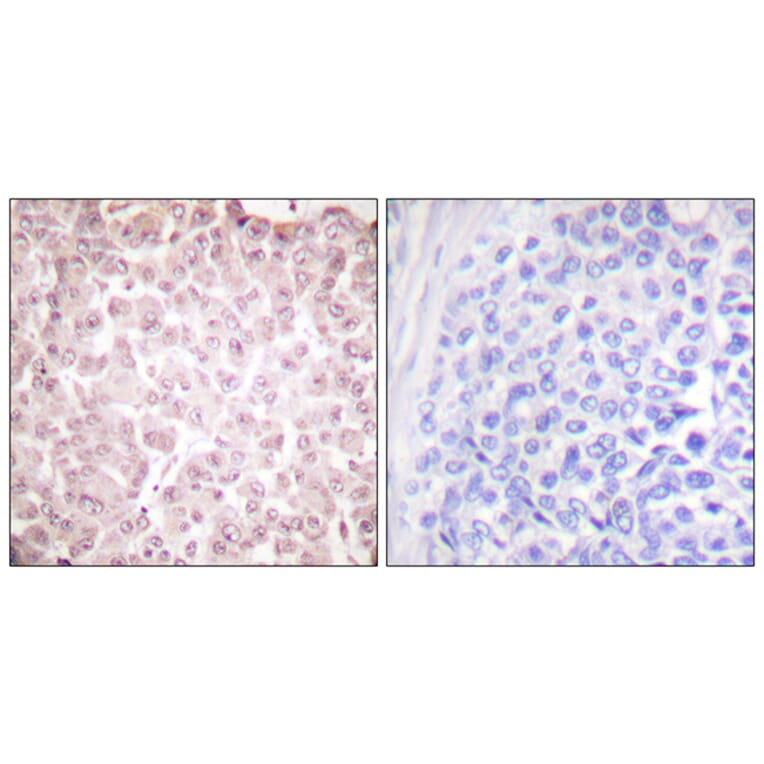 Immunohistochemistry - Anti-RCBTB1 Antibody (C0314) - Antibodies.com