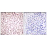 Immunohistochemistry - Anti-RCBTB1 Antibody (C0314) - Antibodies.com