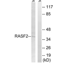 Western Blot - Anti-RASSF2 Antibody (C18180) - Antibodies.com