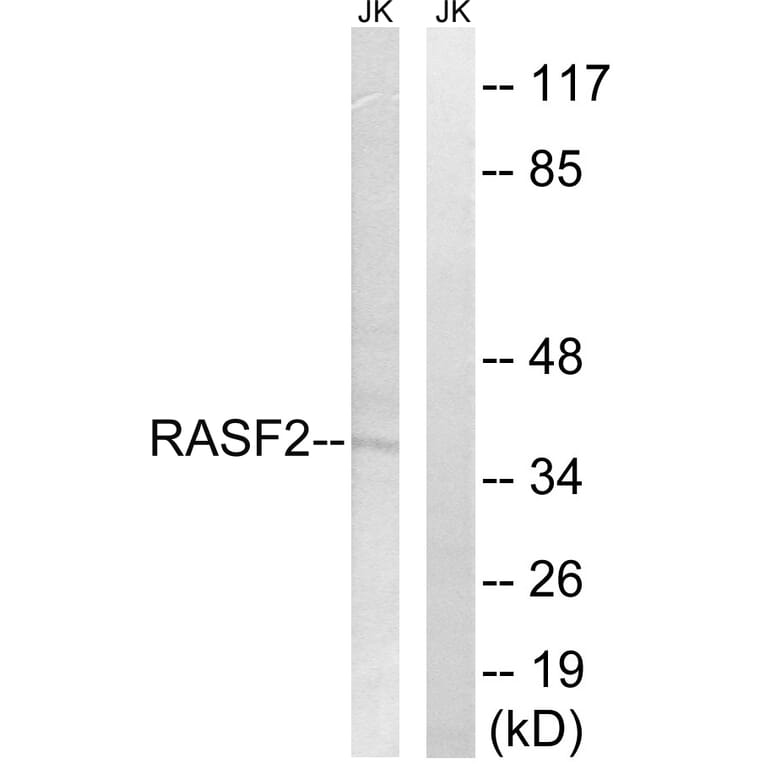 Western Blot - Anti-RASSF2 Antibody (C18180) - Antibodies.com