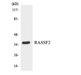 Western Blot - Anti-RASSF2 Antibody (R12-3409) - Antibodies.com