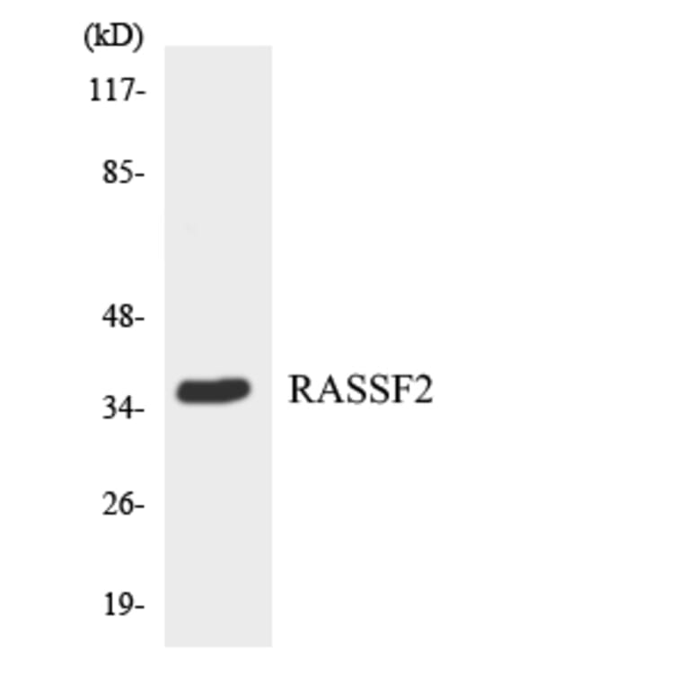 Western Blot - Anti-RASSF2 Antibody (R12-3409) - Antibodies.com