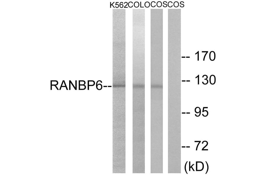 Western Blot - Anti-RANBP6 Antibody (C18159) - Antibodies.com