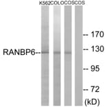 Western Blot - Anti-RANBP6 Antibody (C18159) - Antibodies.com