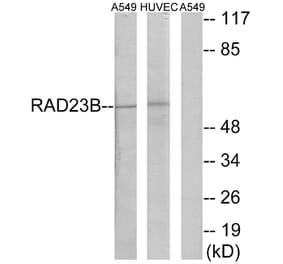 Western Blot - Anti-RAD23B Antibody (C19671) - Antibodies.com