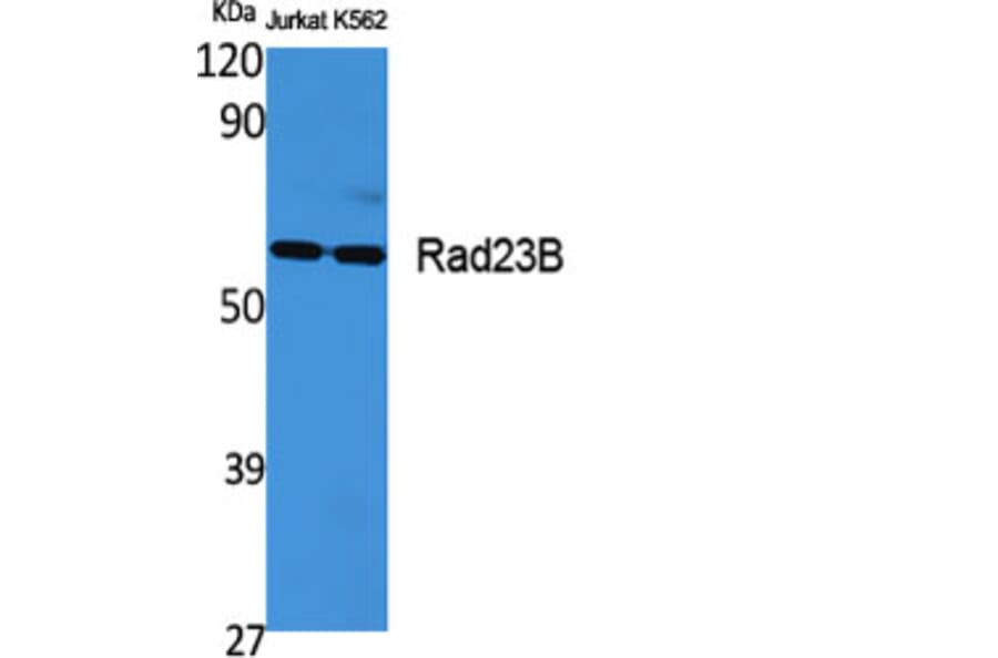 Western Blot - Anti-RAD23B Antibody (C19671) - Antibodies.com