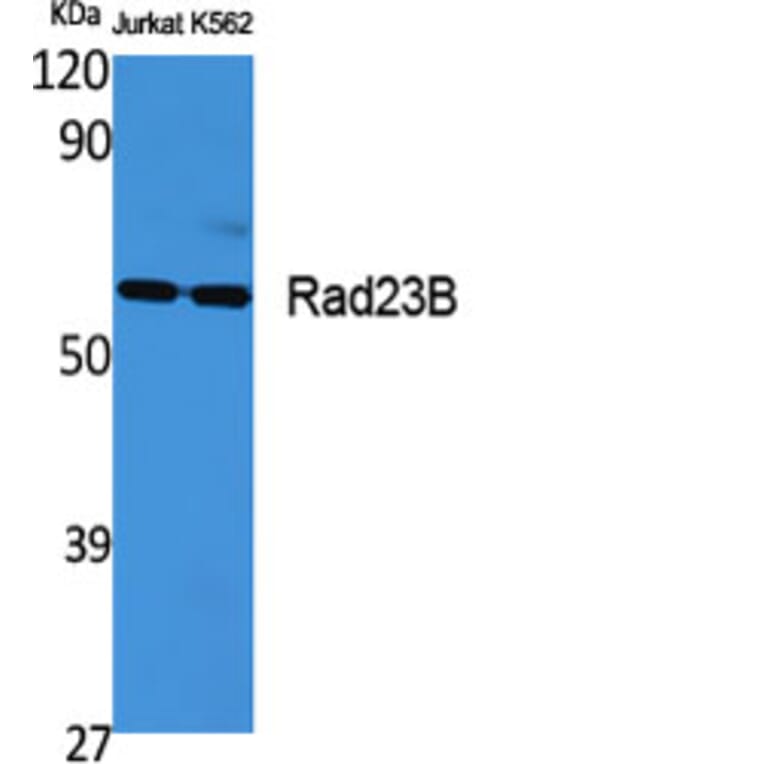 Western Blot - Anti-RAD23B Antibody (C19671) - Antibodies.com
