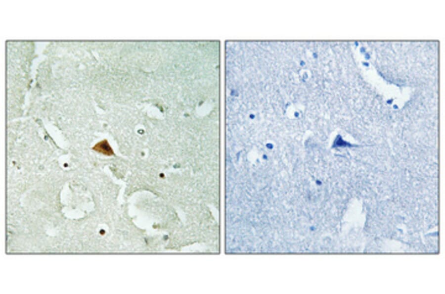 Immunohistochemistry - Anti-RAD23B Antibody (C19671) - Antibodies.com