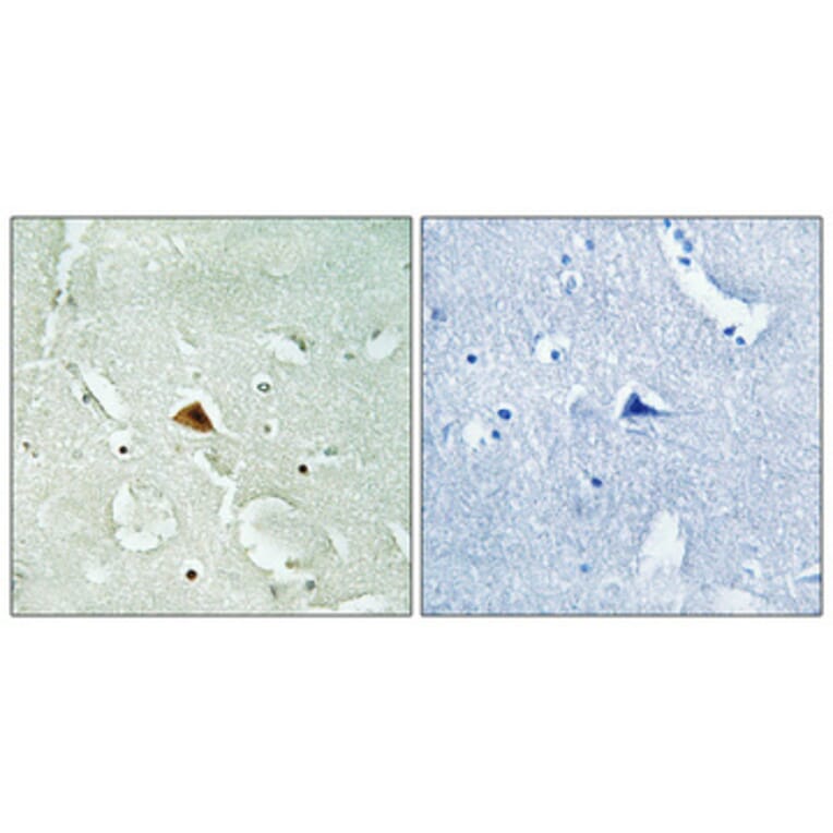 Immunohistochemistry - Anti-RAD23B Antibody (C19671) - Antibodies.com