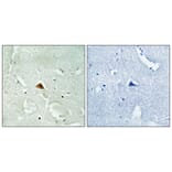 Immunohistochemistry - Anti-RAD23B Antibody (C19671) - Antibodies.com