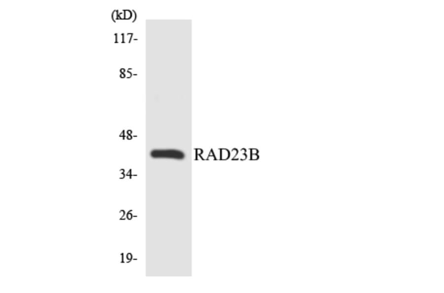 Western Blot - Anti-RAD23B Antibody (R12-3398) - Antibodies.com