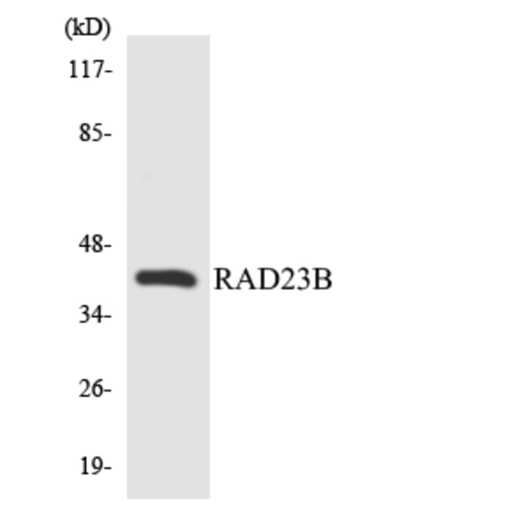 Western Blot - Anti-RAD23B Antibody (R12-3398) - Antibodies.com