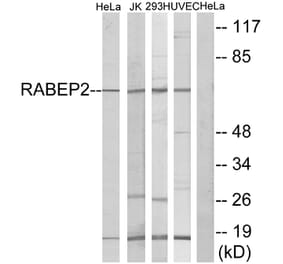 Western Blot - Anti-RABEP2 Antibody (C18116) - Antibodies.com