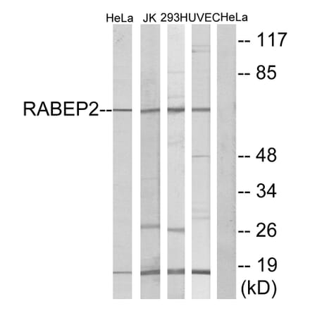 Western Blot - Anti-RABEP2 Antibody (C18116) - Antibodies.com