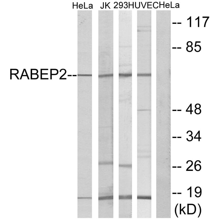 Western Blot - Anti-RABEP2 Antibody (C18116) - Antibodies.com