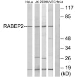 Western Blot - Anti-RABEP2 Antibody (C18116) - Antibodies.com