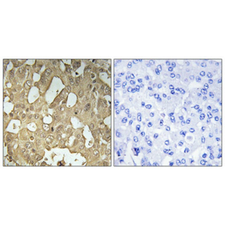 Immunohistochemistry - Anti-RABEP2 Antibody (C18116) - Antibodies.com