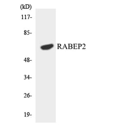 Western Blot - Anti-RABEP2 Antibody (R12-3395) - Antibodies.com