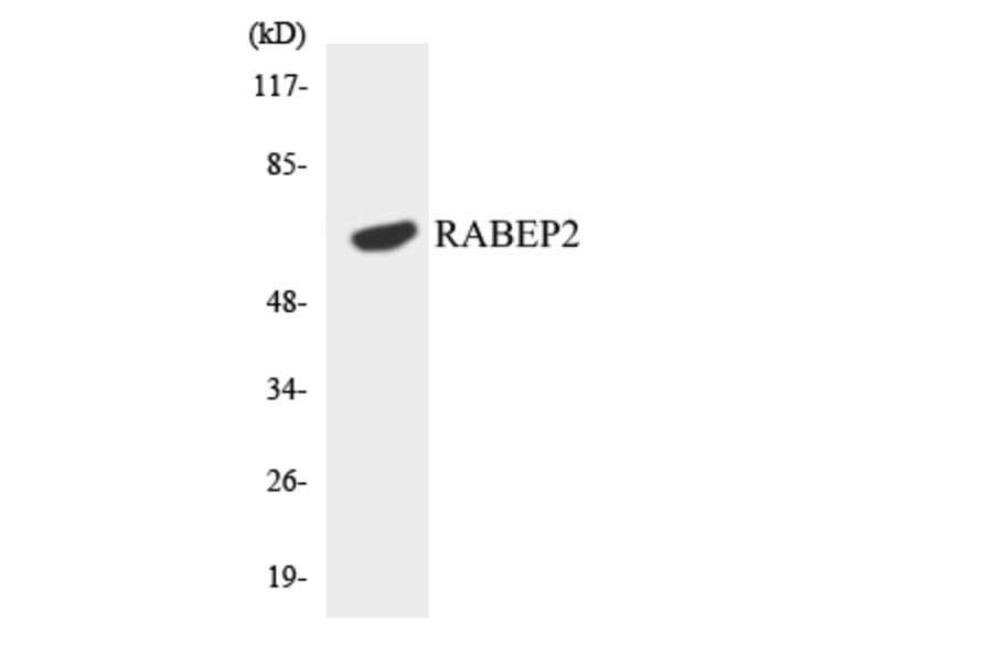 Western Blot - Anti-RABEP2 Antibody (R12-3395) - Antibodies.com
