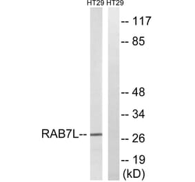 Western Blot - Anti-RAB7L1 Antibody (C18271) - Antibodies.com