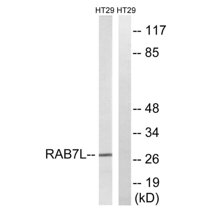 Western Blot - Anti-RAB7L1 Antibody (C18271) - Antibodies.com