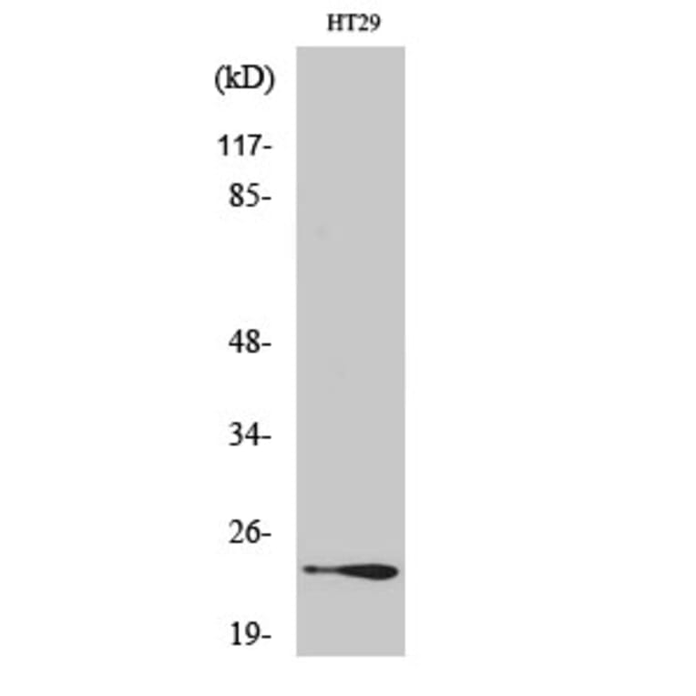 Western Blot - Anti-RAB7L1 Antibody (C18271) - Antibodies.com