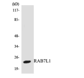 Western Blot - Anti-RAB7L1 Antibody (R12-3394) - Antibodies.com