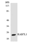 Western Blot - Anti-RAB7L1 Antibody (R12-3394) - Antibodies.com